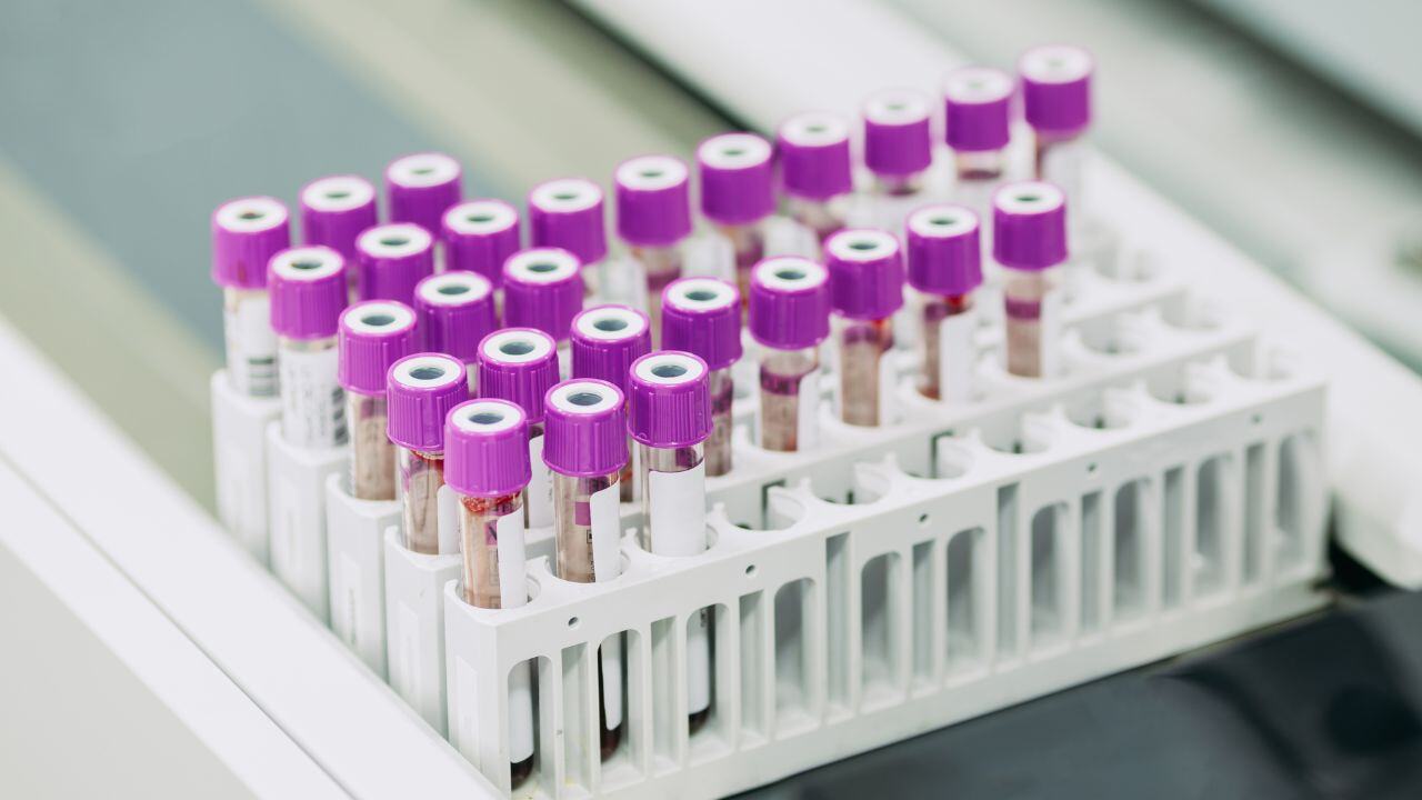 Informes sobre impurezas orgánicas